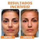 Kit Máscara GoldBotox - Frete Grátis - 29% OFF + Brinde 🎁  APENAS HOJE!